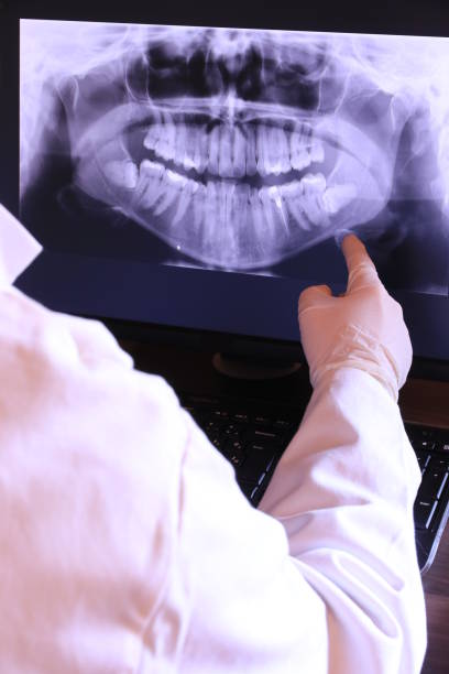 Best Emergency Dental Extractions in Winfield, MO