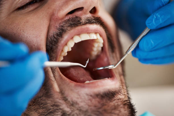 Best Emergency Dentist for Knocked-Out Tooth in Winfield, MO