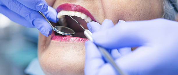 Best Emergency Dental Care for Abscessed Tooth in Winfield, MO
